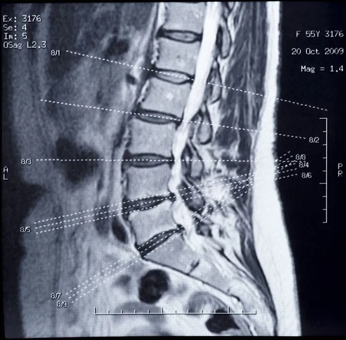 Browning Family Chiropractic & Wellness ad