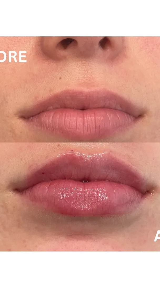 Glow Aesthetic Center Med Spa ad