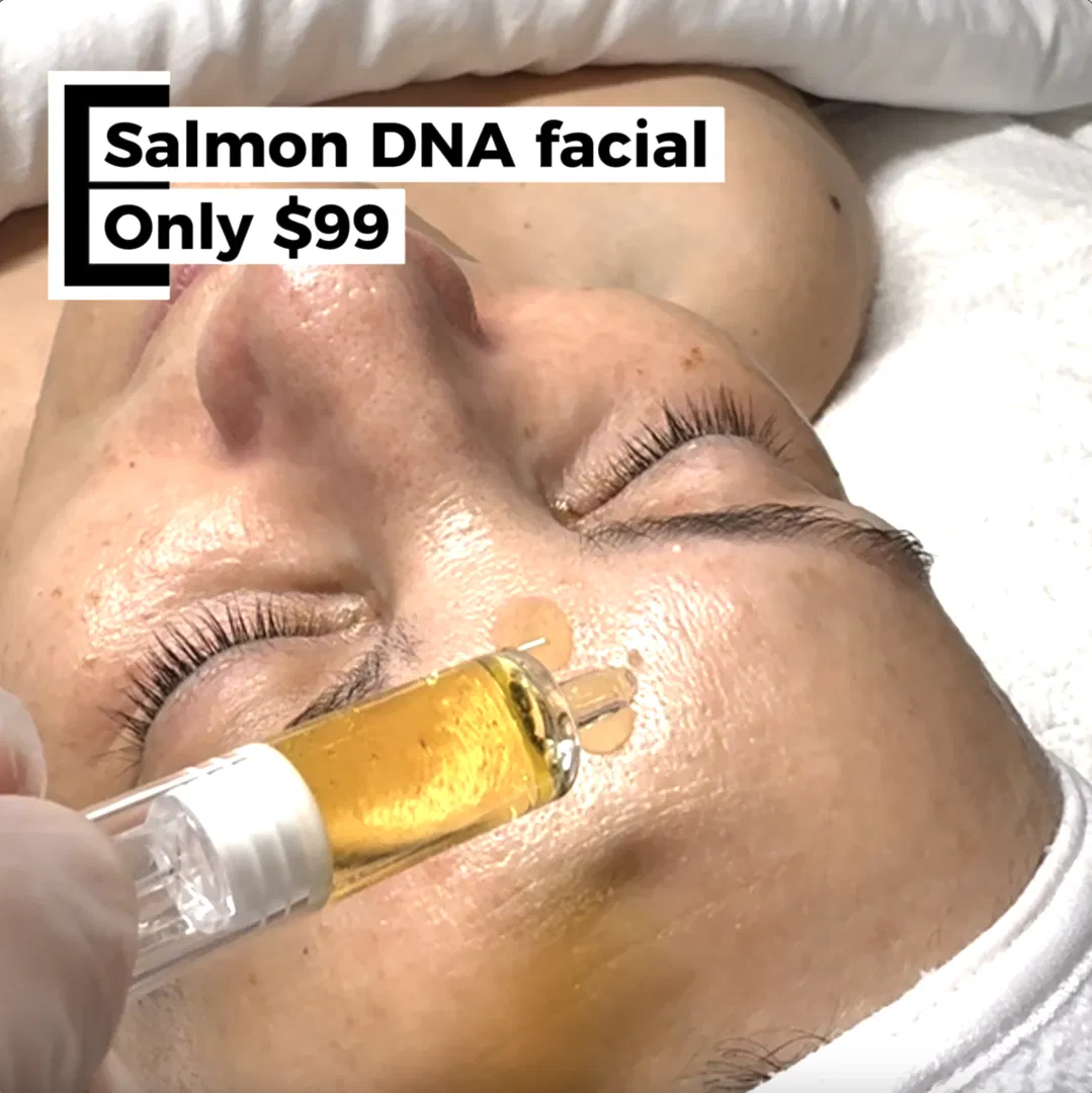 Idan Med Spa ad
