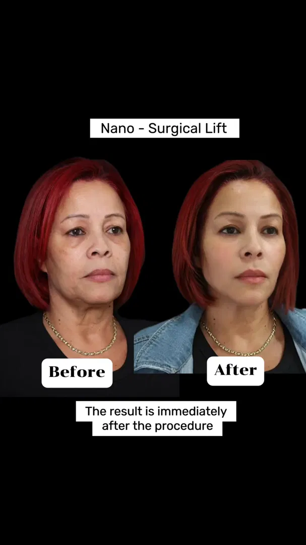 BEIAMED MEDSPA & CLINIC ad