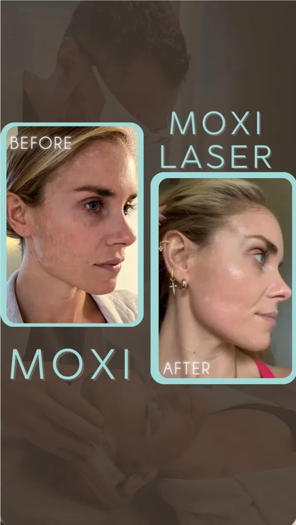 Omni Sculpt MD ad