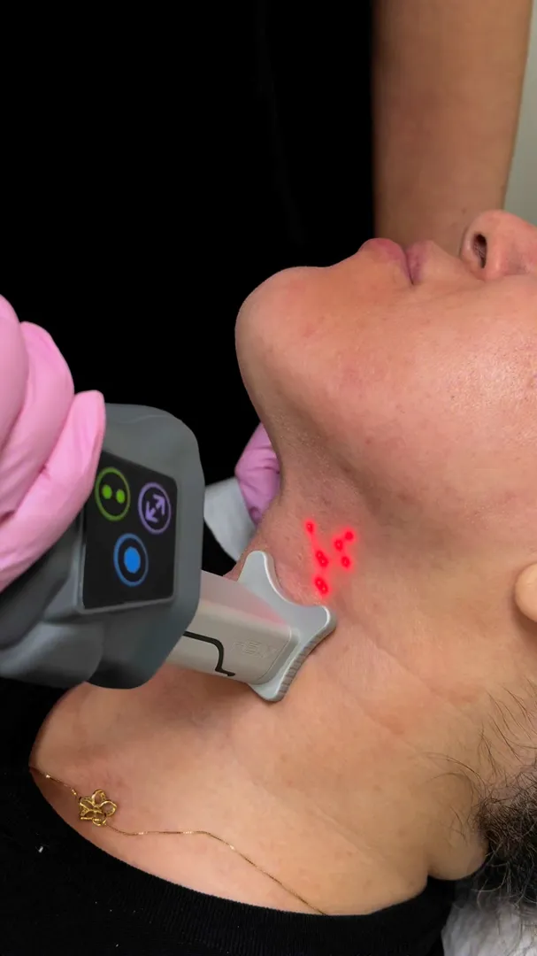 Renove Medical Spa ad